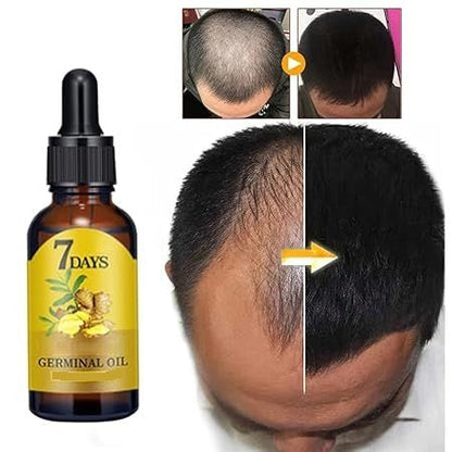7 Day Ginger Hair Growth Oil